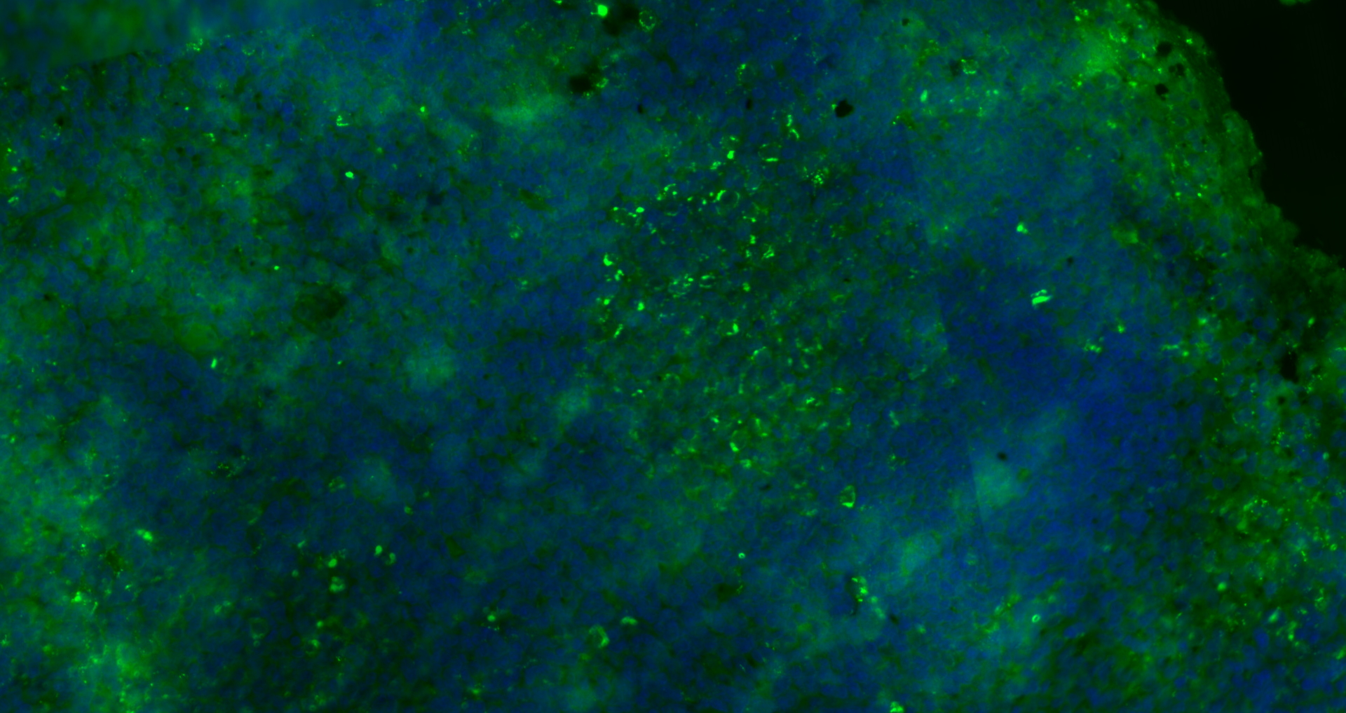 Paraformaldehyde-fixed, paraffin embedded (mouse lymphoid); Antigen retrieval by boiling in sodium citrate buffer (pH6.0) for 15min; Blocking buffer (normal goat serum) at 37°C for 30min; Antibody incubation with (CD8B) Polyclonal Antibody, Unconjugated (bs-4914R) at 1:200 overnight at 4°C, followed by a conjugated Goat Anti-Rabbit IgG antibody (bs-0295G-FITC) for 90 minutes, and DAPI for nuclei staining.