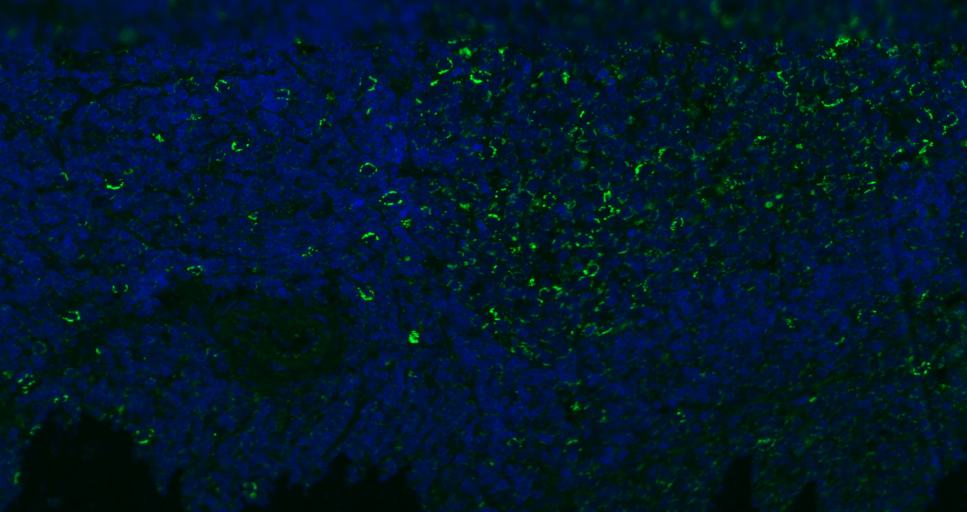 Paraformaldehyde-fixed, paraffin embedded (mouse spleen); Antigen retrieval by boiling in sodium citrate buffer (pH6.0) for 15min; Blocking buffer (normal goat serum) at 37°C for 30min; Antibody incubation with (CD8B) Polyclonal Antibody, Unconjugated (bs-4914R) at 1:200 overnight at 4°C, followed by a conjugated Goat Anti-Rabbit IgG antibody (bs-0295G-FITC) for 90 minutes, and DAPI for nuclei staining.