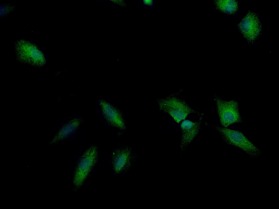A549 cell; 4% Paraformaldehyde-fixed; Ice-cold methanol at -20℃ for 20 min; Blocking buffer (normal goat serum, C-0005) at 37°C for 20 min; Antibody incubation with (AMPK alpha-1) polyclonal Antibody, Unconjugated (bs-10344R) 1:100, 90 minutes at 37°C; followed by a FITC conjugated Goat Anti-Rabbit IgG antibody at 37°C for 90 minutes, DAPI (blue, C02-04002) was used to stain the cell nuclei.
