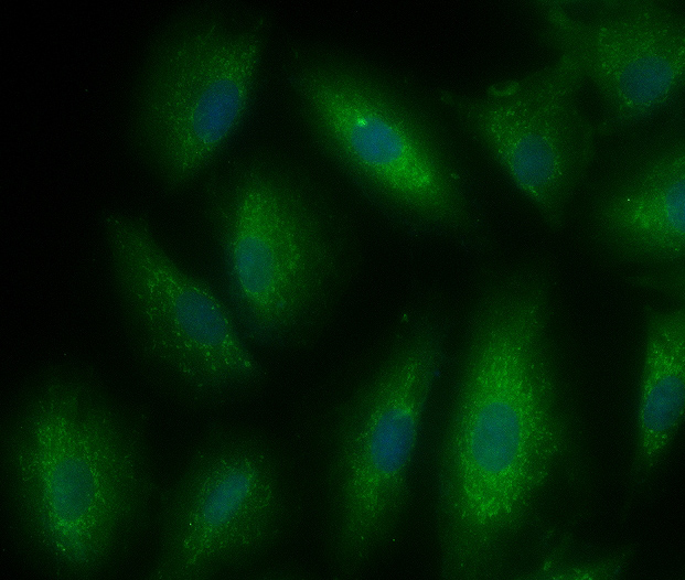 A549 cell; 4% Paraformaldehyde-fixed; Ice-cold methanol at -20℃ for 20 min; Blocking buffer (normal goat serum, C-0005) at 37°C for 20 min; Antibody incubation with (Ferritin Heavy Chain) polyclonal Antibody, Unconjugated (bs-5907R) 1:100, 90 minutes at 37°C; followed by a FITC conjugated Goat Anti-Rabbit IgG antibody at 37°C for 90 minutes, DAPI (blue, C02-04002) was used to stain the cell nuclei.