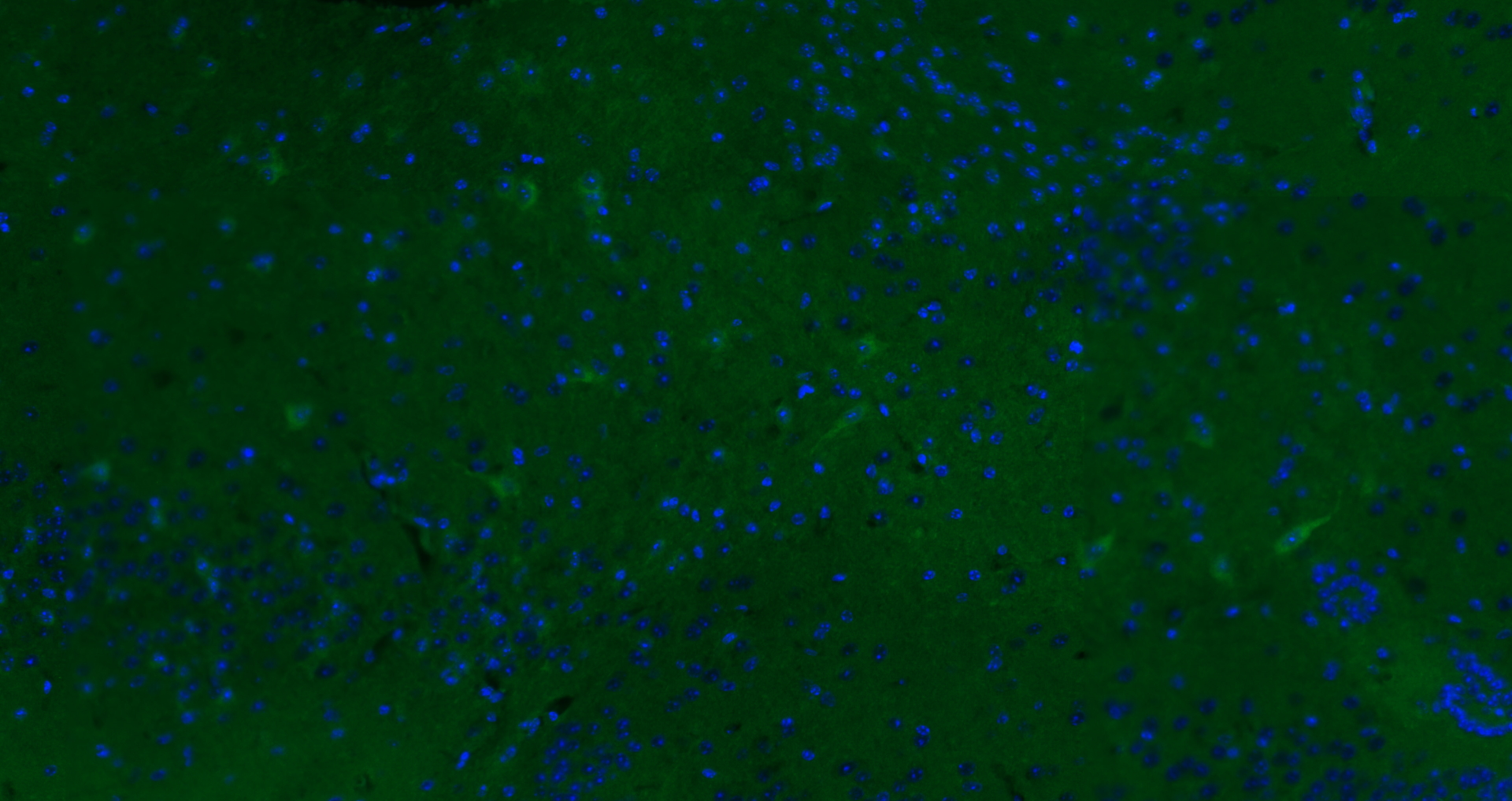 Paraformaldehyde-fixed, paraffin embedded (mouse brain); Antigen retrieval by boiling in sodium citrate buffer (pH6.0) for 15min; Blocking buffer (normal goat serum) at 37°C for 30min; Antibody incubation with (KCNG3) Polyclonal Antibody, Unconjugated (bs-12175R) at 1:200 overnight at 4°C, followed by a conjugated Goat Anti-Rabbit IgG antibody (bs-0295G-AF488) for 90 minutes, and DAPI for nuclei staining.