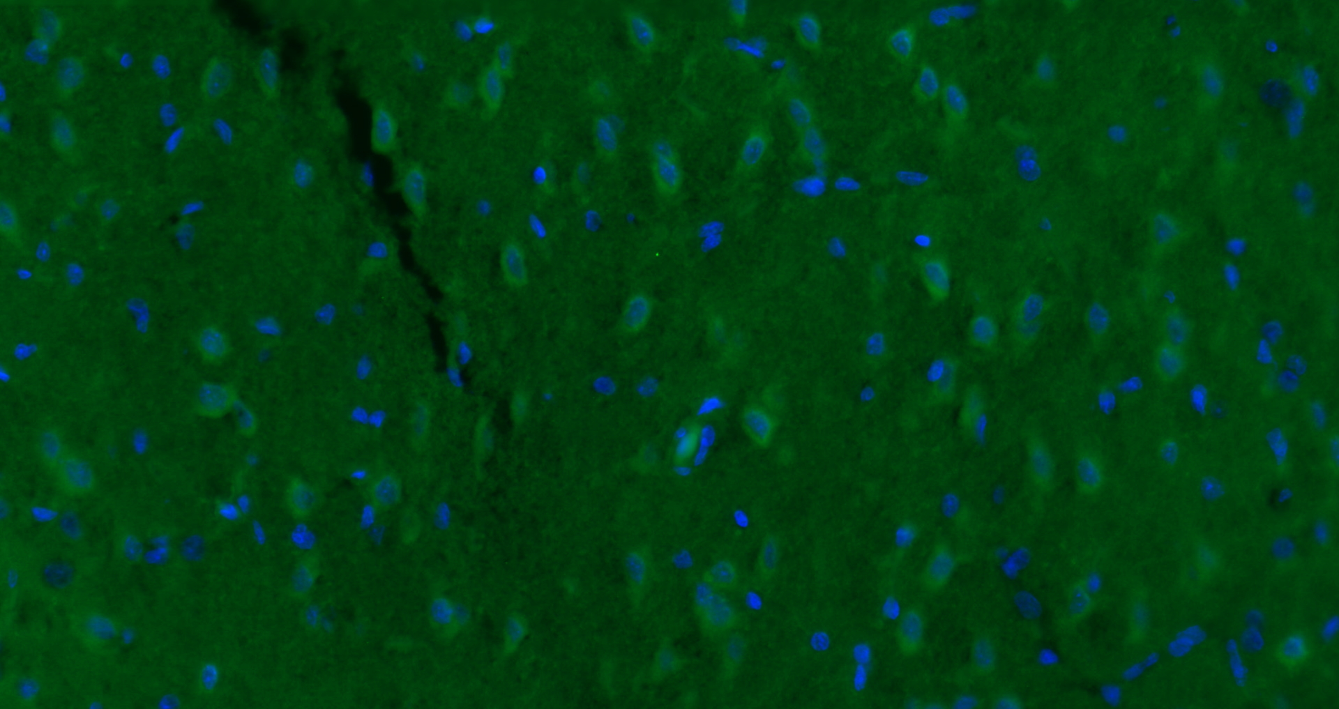 Paraformaldehyde-fixed, paraffin embedded (rat brain); Antigen retrieval by boiling in sodium citrate buffer (pH6.0) for 15min; Blocking buffer (normal goat serum) at 37°C for 30min; Antibody incubation with (KCNG3) Polyclonal Antibody, Unconjugated (bs-12175R) at 1:200 overnight at 4°C, followed by a conjugated Goat Anti-Rabbit IgG antibody (bs-0295G-AF488) for 90 minutes, and DAPI for nuclei staining.