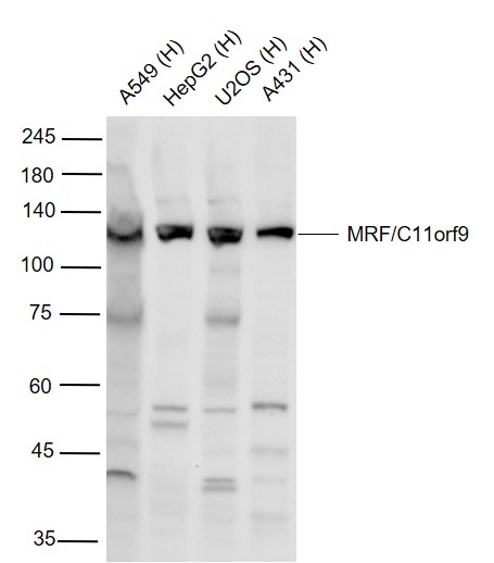 Lane 1: Human A549 cell lysates; Lane 2: Human HepG2 cell lysates; Lane 3: Human U2OS cell; Lane 4: Human A431 cell lysates; lysates probed with MRF\/C11orf9 Polyclonal Antibody, Unconjugated (bs-11191R) at 1:1000 dilution and 4\u00b0C overnight incubation. Followed by conjugated secondary antibody incubation at 1:20000 for 60 min at 37˚C.
