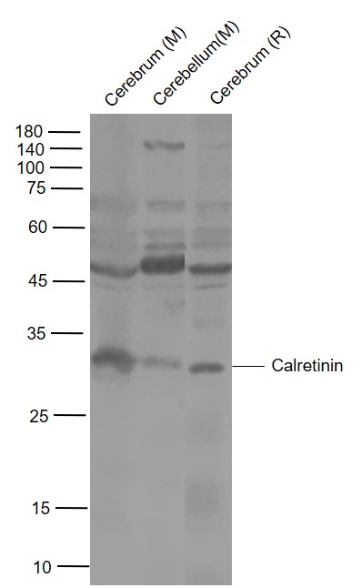 Lane 1: Mouse Cerebrum lysates; Lane 2: Mouse Cerebellum lysates; Lane 3: Rat Cerebrum lysates probed with Calretinin Polyclonal Antibody, Unconjugated (bs-0062R) at 1:1000 dilution and 4°C overnight incubation. Followed by conjugated secondary antibody incubation at 1:20000 for 60 min at 37˚C.