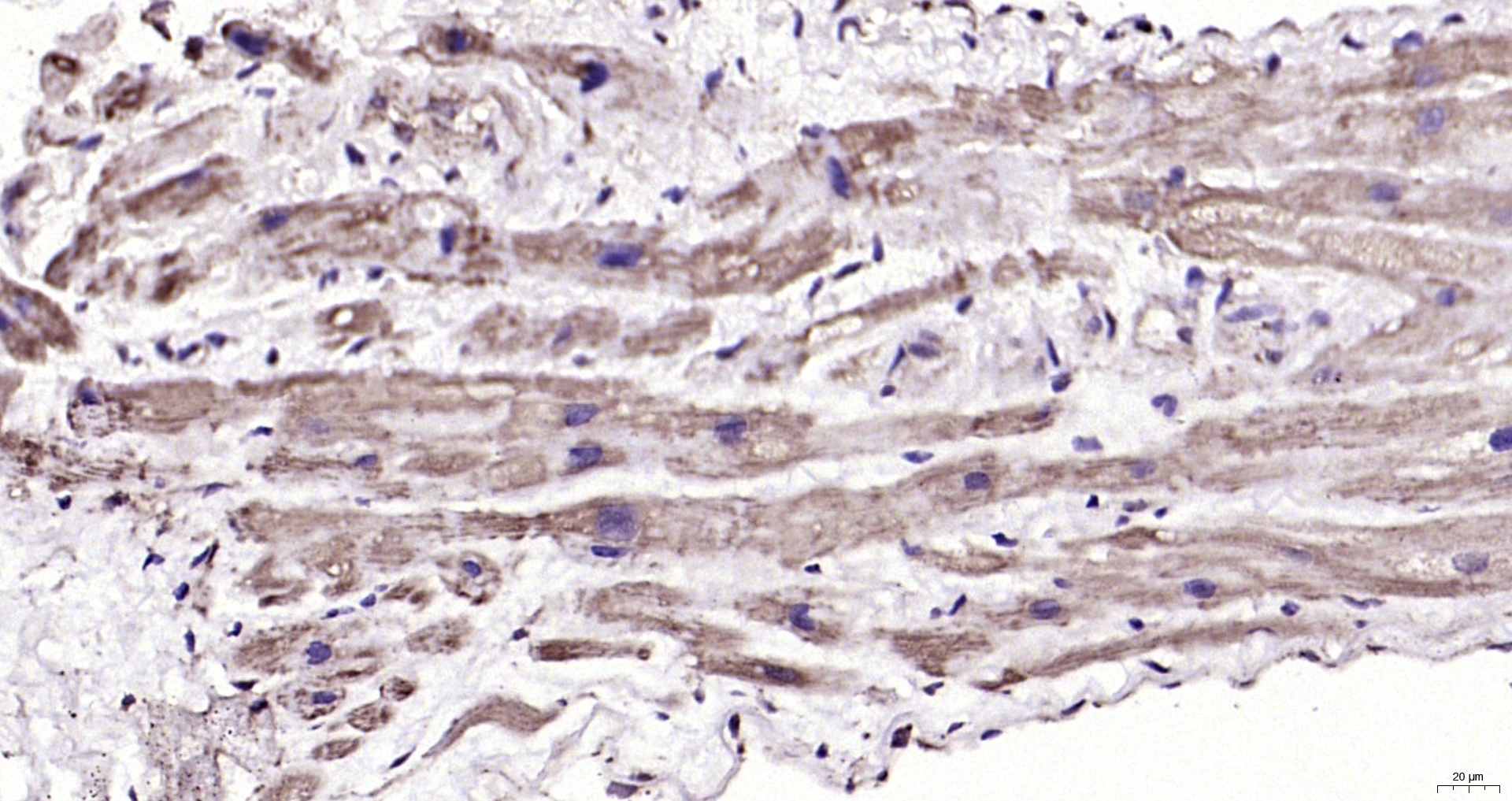 Paraformaldehyde-fixed, paraffin embedded (human myocardium); Antigen retrieval by boiling in sodium citrate buffer (pH6.0) for 15min; Block endogenous peroxidase by 3% hydrogen peroxide for 20 minutes; Blocking buffer (normal goat serum) at 37°C for 30min; Antibody incubation with (APPBP1) Polyclonal Antibody, Unconjugated (bs-12503R) at 1:200 overnight at 4°C, followed by operating according to SP Kit(Rabbit) (sp-0023) instructionsand DAB staining.