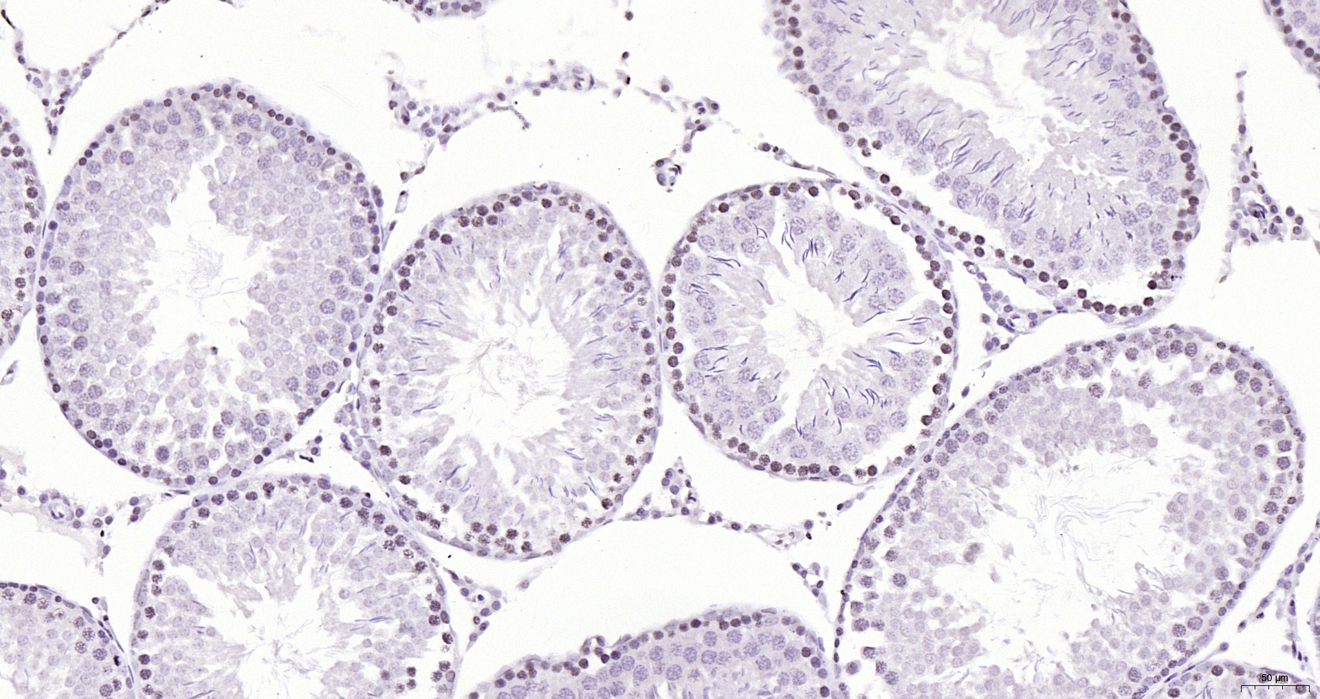 Paraformaldehyde-fixed, paraffin embedded (rat testis); Antigen retrieval by boiling in sodium citrate buffer (pH6.0) for 15min; Block endogenous peroxidase by 3% hydrogen peroxide for 20 minutes; Blocking buffer (normal goat serum) at 37°C for 30min; Antibody incubation with (FOXJ1) Polyclonal Antibody, Unconjugated (bs-1775R) at 1:200 overnight at 4°C, followed by operating according to SP Kit(Rabbit) (sp-0023) instructionsand DAB staining. Paraformaldehyde-fixed, paraffin embedded (rat testis); Antigen retrieval by boiling in sodium citrate buffer (pH6.0) for 15min; Block endogenous peroxidase by 3% hydrogen peroxide for 20 minutes; Blocking buffer (normal goat serum) at 37°C for 30min; Antibody incubation with (FOXJ1) Polyclonal Antibody, Unconjugated (bs-1775R) at 1:200 overnight at 4°C, followed by operating according to SP Kit(Rabbit) (sp-0023) instructionsand DAB staining.