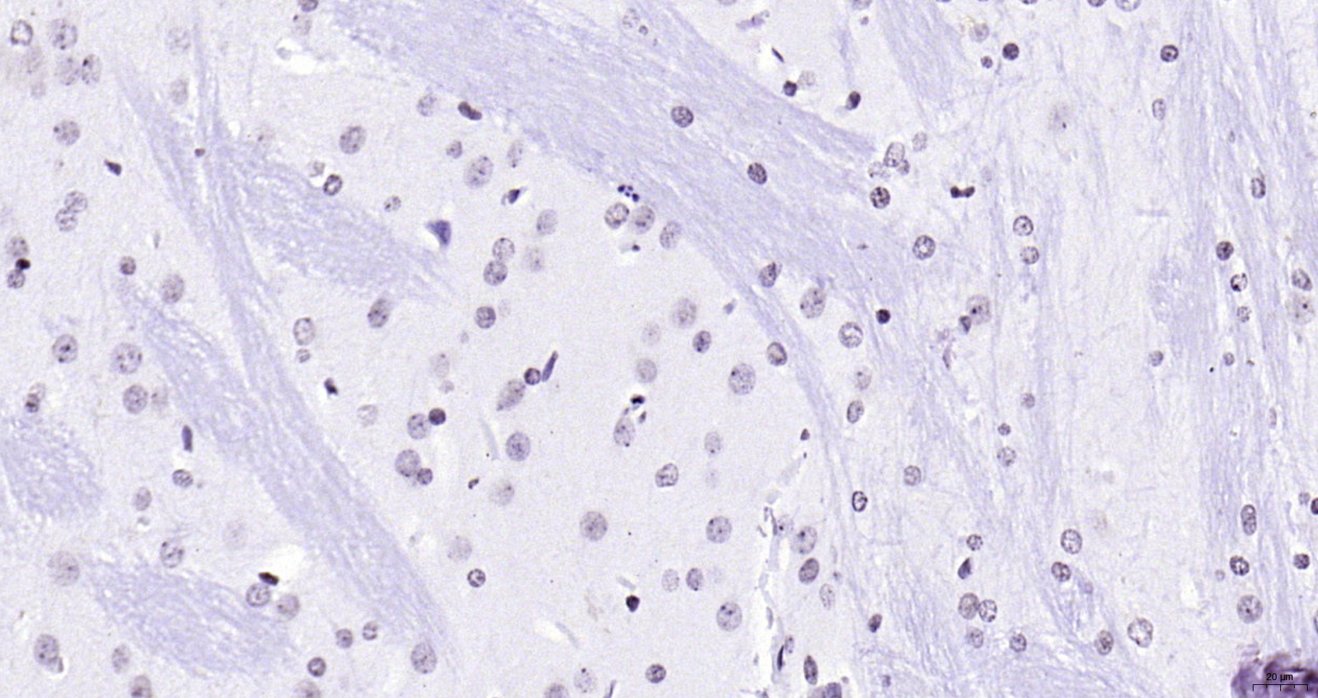 Paraformaldehyde-fixed, paraffin embedded (rat brain); Antigen retrieval by boiling in sodium citrate buffer (pH6.0) for 15min; Block endogenous peroxidase by 3% hydrogen peroxide for 20 minutes; Blocking buffer (normal goat serum) at 37°C for 30min; Antibody incubation with (FOXJ1) Polyclonal Antibody, Unconjugated (bs-1775R) at 1:200 overnight at 4°C, followed by operating according to SP Kit(Rabbit) (sp-0023) instructionsand DAB staining. Paraformaldehyde-fixed, paraffin embedded (rat brain); Antigen retrieval by boiling in sodium citrate buffer (pH6.0) for 15min; Block endogenous peroxidase by 3% hydrogen peroxide for 20 minutes; Blocking buffer (normal goat serum) at 37°C for 30min; Antibody incubation with (FOXJ1) Polyclonal Antibody, Unconjugated (bs-1775R) at 1:200 overnight at 4°C, followed by operating according to SP Kit(Rabbit) (sp-0023) instructionsand DAB staining.