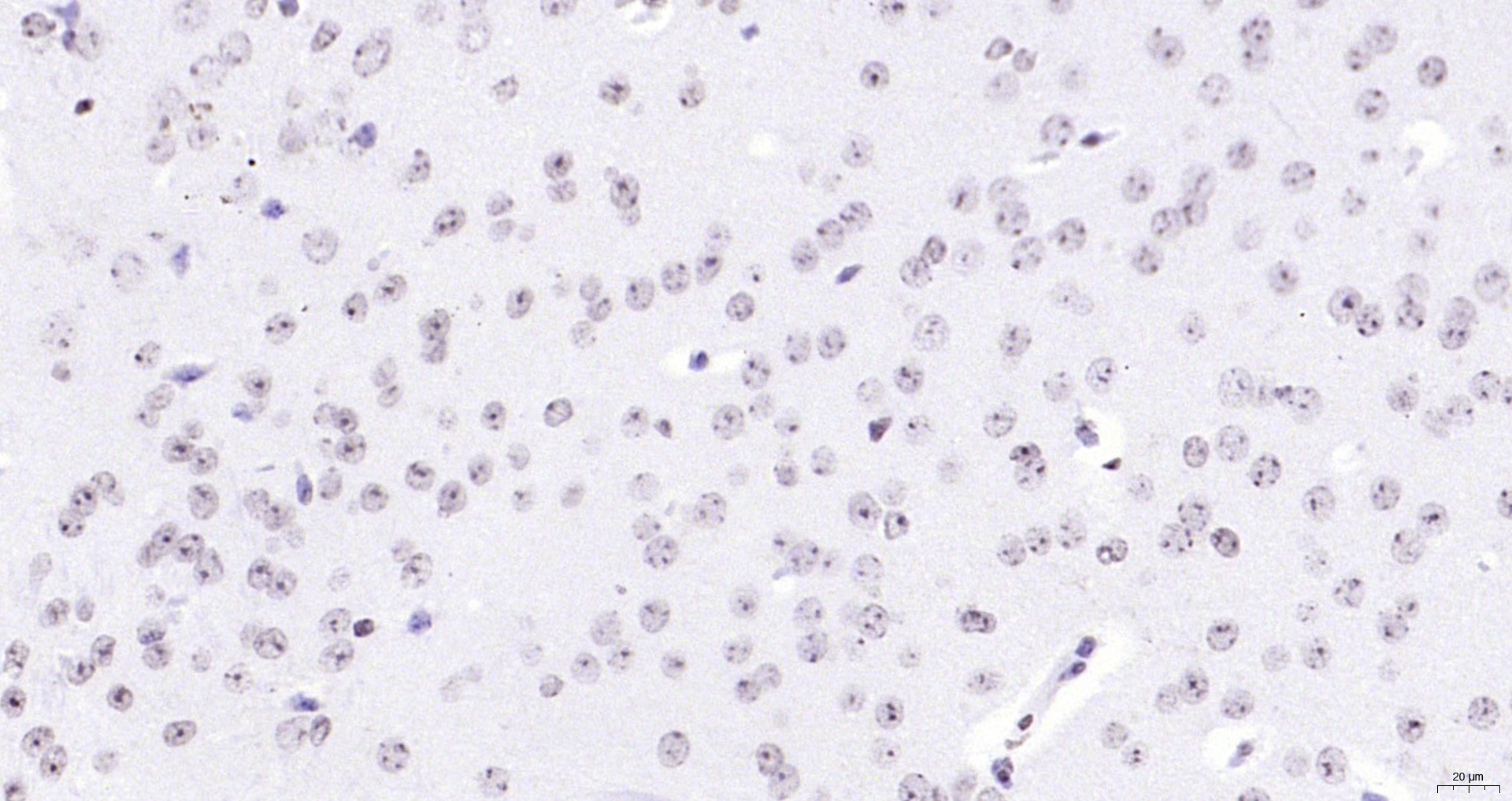 Paraformaldehyde-fixed, paraffin embedded (mouse brain); Antigen retrieval by boiling in sodium citrate buffer (pH6.0) for 15min; Block endogenous peroxidase by 3% hydrogen peroxide for 20 minutes; Blocking buffer (normal goat serum) at 37°C for 30min; Antibody incubation with (FOXJ1) Polyclonal Antibody, Unconjugated (bs-1775R) at 1:200 overnight at 4°C, followed by operating according to SP Kit(Rabbit) (sp-0023) instructionsand DAB staining. Paraformaldehyde-fixed, paraffin embedded (mouse brain); Antigen retrieval by boiling in sodium citrate buffer (pH6.0) for 15min; Block endogenous peroxidase by 3% hydrogen peroxide for 20 minutes; Blocking buffer (normal goat serum) at 37°C for 30min; Antibody incubation with (FOXJ1) Polyclonal Antibody, Unconjugated (bs-1775R) at 1:200 overnight at 4°C, followed by operating according to SP Kit(Rabbit) (sp-0023) instructionsand DAB staining.