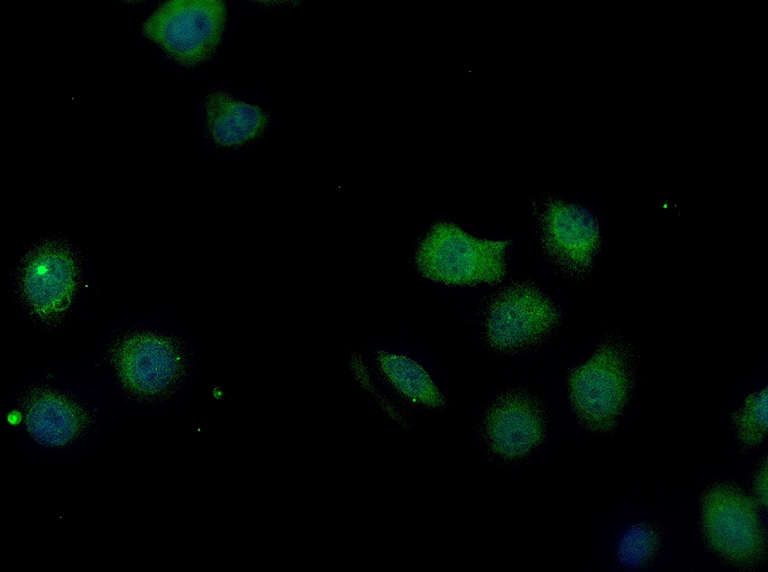 HepG2 cell; 4% Paraformaldehyde-fixed; Triton X-100 at room temperature for 20 min; Blocking buffer (normal goat serum, C-0005) at 37°C for 20 min; Antibody incubation with (Fbxw7) polyclonal Antibody, Unconjugated (bs-8394R) 1:100, 90 minutes at 37°C; followed by a conjugated Goat Anti-Rabbit IgG antibody at 37°C for 90 minutes, DAPI (blue, C02-04002) was used to stain the cell nuclei. HepG2 cell; 4% Paraformaldehyde-fixed; Triton X-100 at room temperature for 20 min; Blocking buffer (normal goat serum, C-0005) at 37°C for 20 min; Antibody incubation with (Fbxw7) polyclonal Antibody, Unconjugated (bs-8394R) 1:100, 90 minutes at 37°C; followed by a conjugated Goat Anti-Rabbit IgG antibody at 37°C for 90 minutes, DAPI (blue, C02-04002) was used to stain the cell nuclei.