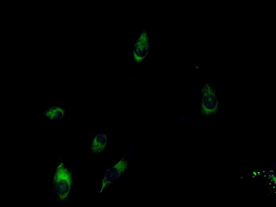 A549 cell; 4% Paraformaldehyde-fixed; Triton X-100 at room temperature for 20 min; Blocking buffer (normal goat serum, C-0005) at 37°C for 20 min; Antibody incubation with (NDUFV2) polyclonal Antibody, Unconjugated (bs-3960R) 1:100, 90 minutes at 37°C; followed by a conjugated Goat Anti-Rabbit IgG antibody at 37°C for 90 minutes, DAPI (blue, C02-04002) was used to stain the cell nuclei.