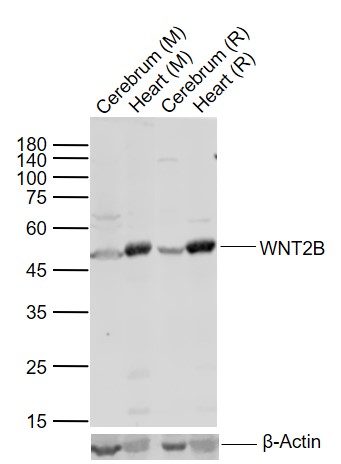 Lane 1: Mouse Cerebrum tissue lysates; Lane 2: Mouse Heart tissue lysates; Lane 3: Rat Cerebrum tissue lysates; Lane 4: Rat Heart tissue lysates probed with WNT2B Polyclonal Antibody, Unconjugated (bs-1946R) at 1:1000 dilution and 4°C overnight incubation. Followed by conjugated secondary antibody incubation at 1:20000 for 60 min at 37˚C.