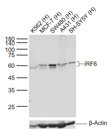 Lane 1: Human K562 cell lysates; Lane 2: Human MCF-7 cell lysates; Lane 3: Human SW480 cell lysates; Lane 4: Human A431 cell lysates ; Lane 5: Human SH-SY5Y cell lysates probed with IRF6 Monoclonal Antibody, Unconjugated (bsm-52119R) at 1:1000 dilution and 4\u00b0C overnight incubation. Followed by conjugated secondary antibody incubation at 1:20000 for 60 min at 37˚C.