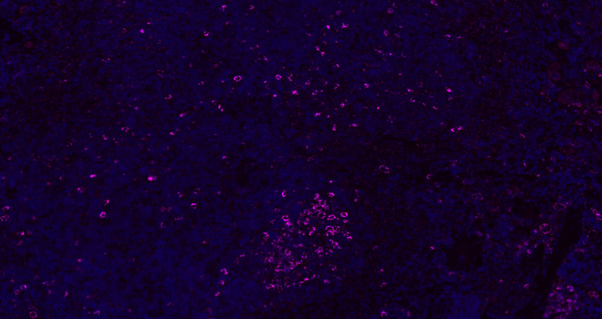 Paraformaldehyde-fixed, paraffin embedded (rat spleen); Antigen retrieval by boiling in sodium citrate buffer (pH6.0) for 15min; Blocking buffer (normal goat serum) at 37\u00b0C for 30min; Antibody incubation with (CD8B) Polyclonal Antibody, Unconjugated (bs-4914R) at 1:100 overnight at 4\u00b0C, followed by a conjugated Goat Anti-Rabbit IgG antibody (bs-0295G-AF647) for 90 minutes, and DAPI for nuclei staining.