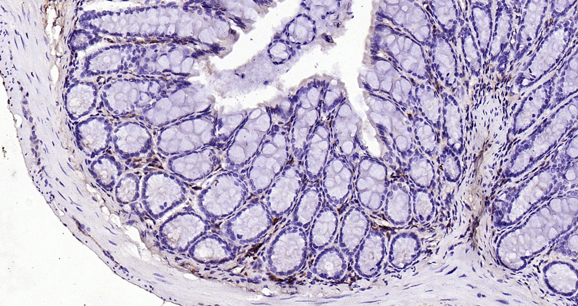 Paraformaldehyde-fixed, paraffin embedded (mouse colon); Antigen retrieval by boiling in sodium citrate buffer (pH6.0) for 15min; Block endogenous peroxidase by 3% hydrogen peroxide for 20 minutes; Blocking buffer (normal goat serum) at 37°C for 30min; Antibody incubation with (CK7) Monoclonal Antibody, Unconjugated (bsm-33060M) at 1:200 overnight at 4°C, followed by operating according to SP Kit(Mouse)(sp-0024) instructionsand DAB staining.