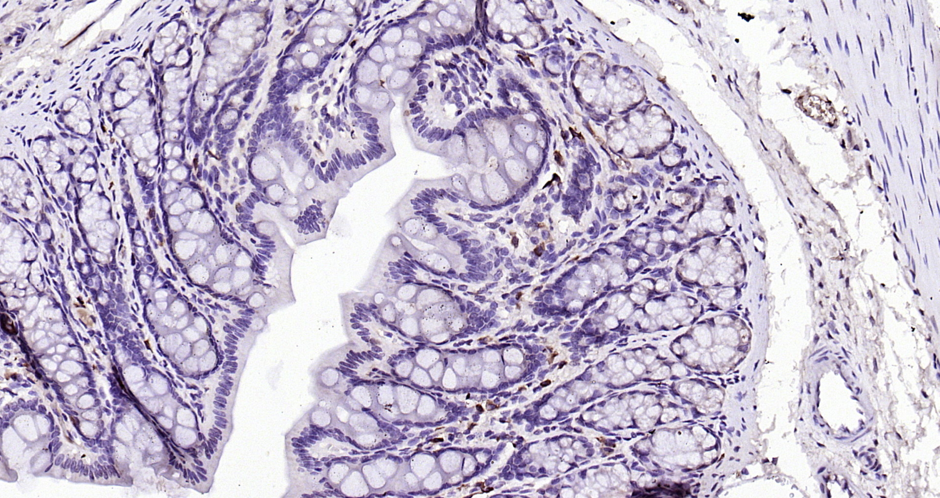Paraformaldehyde-fixed, paraffin embedded (rat colon); Antigen retrieval by boiling in sodium citrate buffer (pH6.0) for 15min; Block endogenous peroxidase by 3% hydrogen peroxide for 20 minutes; Blocking buffer (normal goat serum) at 37°C for 30min; Antibody incubation with (CK7) Monoclonal Antibody, Unconjugated (bsm-33060M) at 1:200 overnight at 4°C, followed by operating according to SP Kit(Mouse)(sp-0024) instructionsand DAB staining.