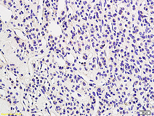 Formalin-fixed and paraffin embedded human adrenal tissue labeled with Anti LHR/CGR Polyclonal Antibody, Unconjugated (bs-6431R) followed by conjugation to the secondary antibody and DAB staining