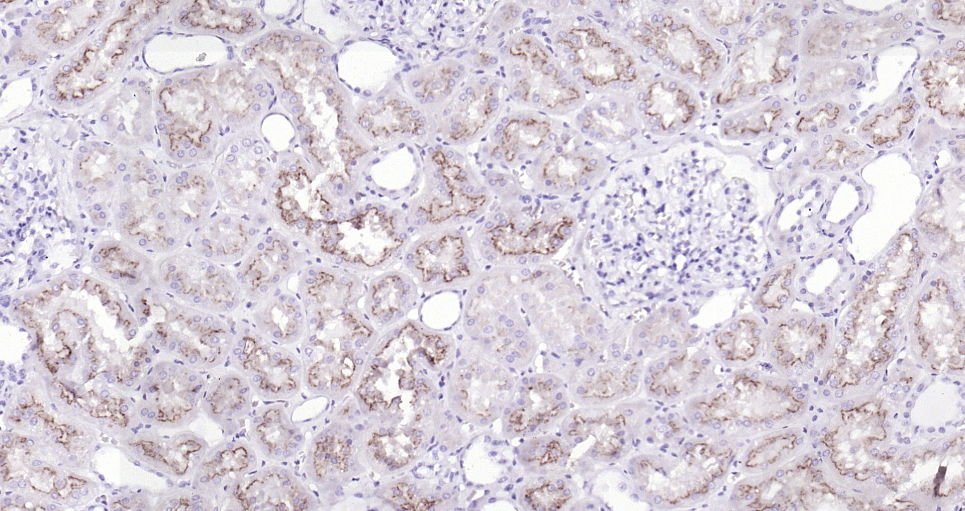 Paraformaldehyde-fixed, paraffin embedded (Human kidney); Antigen retrieval by boiling in sodium citrate buffer (pH6.0) for 15min; Block endogenous peroxidase by 3% hydrogen peroxide for 20 minutes; Blocking buffer (normal goat serum) at 37°C for 30min; Antibody incubation with (Neuropilin-1(49H9) ) Monoclonal Antibody, Unconjugated (bsm-52479R) at 1:200 overnight at 4°C, followed by operating according to SP Kit(Rabbit) (sp-0023) instructionsand DAB staining.