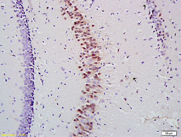 Formalin-fixed and paraffin embedded mouse hippocampus labeled with Anti- KLK10 Polyclonal Antibody, Unconjugated (bs-2531R) at 1:200 followed by conjugation to the secondary antibody