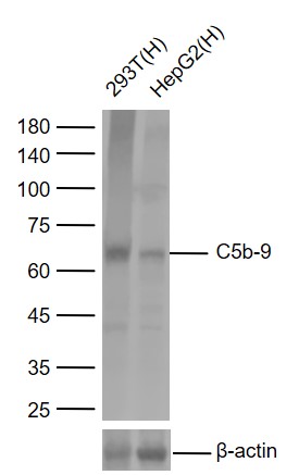 Lane 1: Human 293T cell lysates; Lane 2: Human HepG2 cell lysates probed with C5b-9 Polyclonal Antibody, Unconjugated (bs-2673R) at 1:1000 dilution and 4°C overnight incubation. Followed by conjugated secondary antibody incubation at 1:20000 for 60 min at 37˚C.