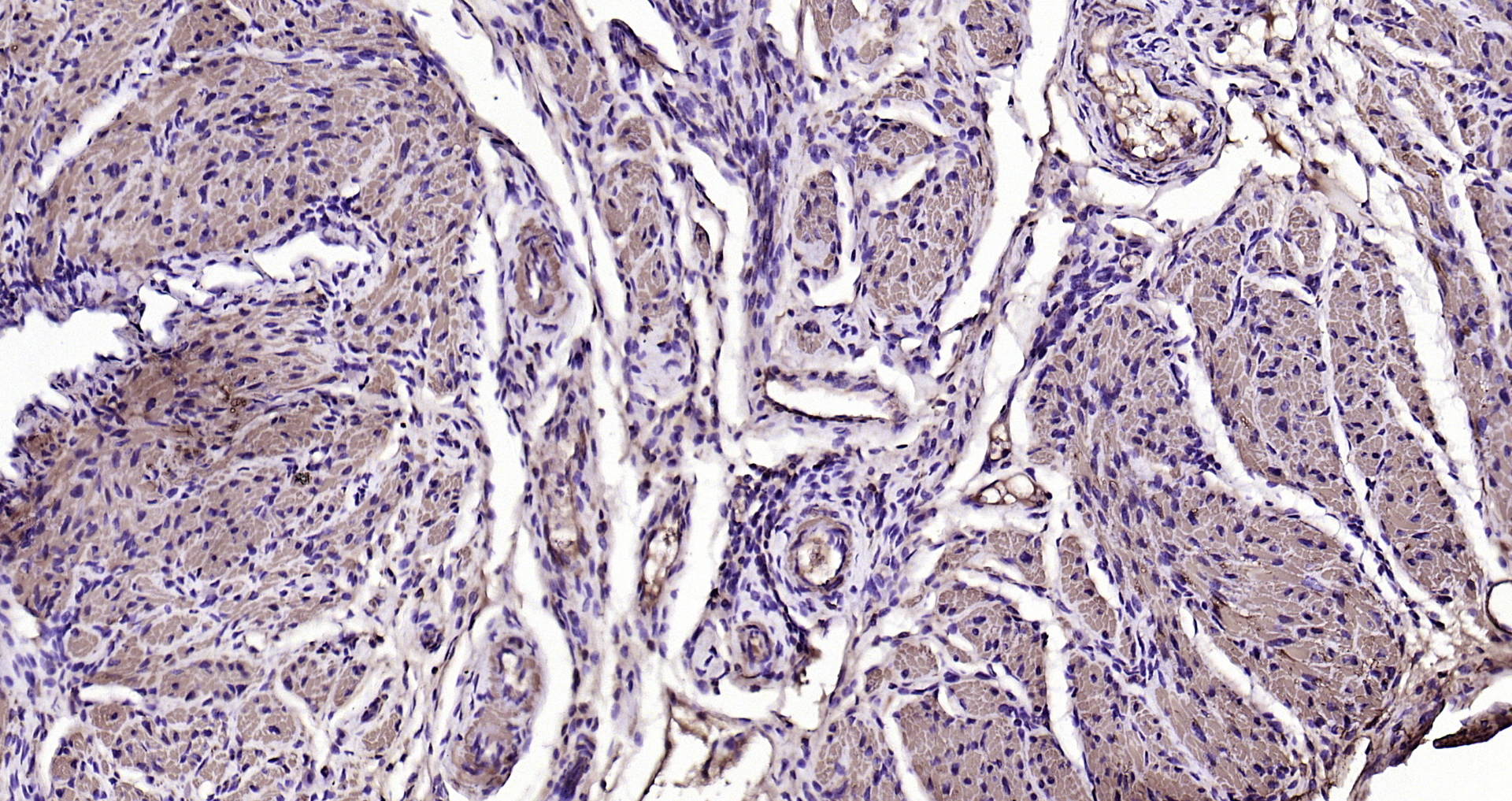 Paraformaldehyde-fixed, paraffin embedded (rat uterus); Antigen retrieval by boiling in sodium citrate buffer (pH6.0) for 15min; Block endogenous peroxidase by 3% hydrogen peroxide for 20 minutes; Blocking buffer (normal goat serum) at 37°C for 30min; Antibody incubation with (ACTA2 (3F9) Monoclonal Antibody, Unconjugated (bsm-33187M) at 1:200 overnight at 4°C, followed by operating according to SP Kit(Mouse)(sp-0024) instructionsand DAB staining.