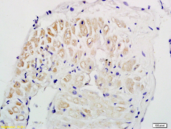 Formalin-fixed and paraffin embedded human myocardial tissue labeled with Anti-CT-1/CTF1 Polyclonal Antibody, Unconjugated (bs-2534R) followed by conjugation to the secondary antibody