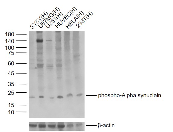 Lane 1: Human SY5Y cell lysates; Lane 2: Human U87MG lysates; Lane 3: Human U251 cell lysates; Lane 4: Human HUVEC cell lysates; Lane 5: Human HELA cell lysates; Lane 6: Human 293T cell lysates probed with phospho-Alpha synuclein (Ser129) Antibody, Unconjugated (bs-5628R) at 1:1000 dilution and 4°C overnight incubation. Followed by conjugated secondary antibody incubation at 1:20000 for 60 min at 37˚C.