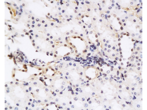 Formalin-fixed and paraffin embedded rat kidney tissue labeled with Anti-HGF Polyclonal Antibody, Unconjugated(bs-1025R) at 1:200, followed by conjugation to the secondary antibody and DAB staining\n