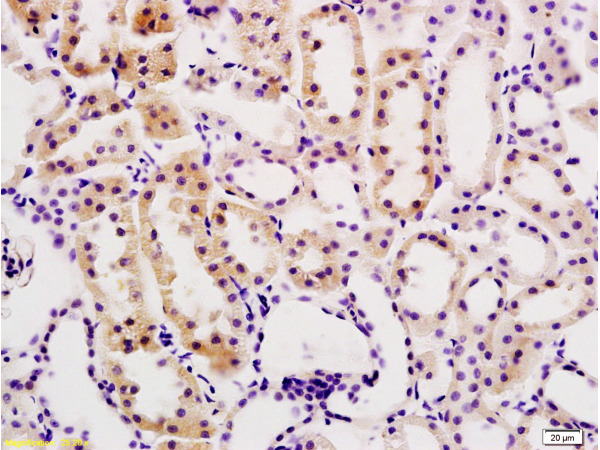 Formalin-fixed and paraffin embedded rat kidney tissue labeled with Anti-Desmin Polyclonal Antibody, Unconjugated (bs-1026R) at 1:200, followed by conjugation to the secondary antibody and DAB staining