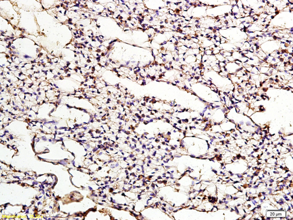 Formalin-fixed and paraffin embedded chicken lung labeled with Anti ApoER2 Polyclonal Antibody, Unconjugated (bs-6651R) at 1:200 followed by conjugation to the secondary antibody and DAB staining Formalin-fixed and paraffin embedded chicken lung labeled with Anti ApoER2 Polyclonal Antibody, Unconjugated (bs-6651R) at 1:200 followed by conjugation to the secondary antibody and DAB staining
