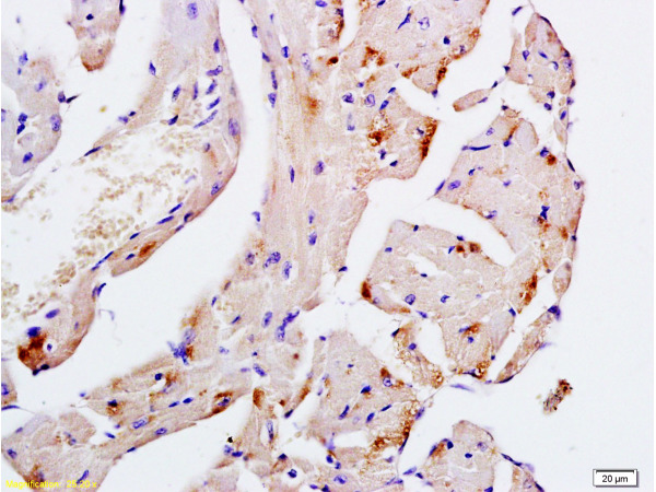 Formalin-fixed and paraffin embedded mouse heart tissue labeled with Anti-Desmin Polyclonal Antibody, Unconjugated (bs-1026R) at 1:200, followed by conjugation to the secondary antibody and DAB staining