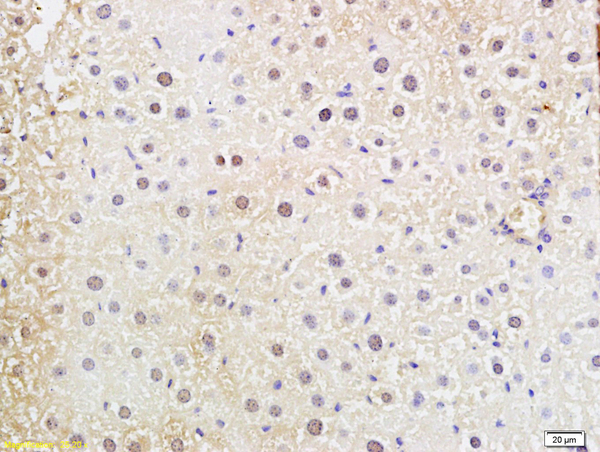 Formalin-fixed and paraffin embedded mouse liver labeled with Anti-DNTT Polyclonal Antibody, Unconjugated (bs-2938R) at 1:200 followed by conjugation to the secondary antibody and DAB staining