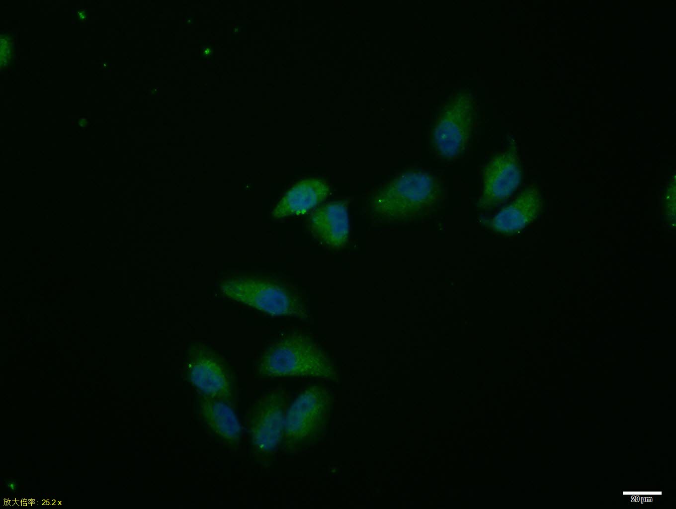 Hela cell; 4% Paraformaldehyde-fixed; Triton X-100 at room temperature for 20 min; Blocking buffer (normal goat serum, C-0005) at 37°C for 20 min; Antibody incubation with (Cytokeratin 42) polyclonal Antibody, Unconjugated (bs-11187R) 1:100, 90 minutes at 37°C; followed by a conjugated Goat Anti-Rabbit IgG antibody at 37°C for 90 minutes, DAPI (blue, C02-04002) was used to stain the cell nuclei. Hela cell; 4% Paraformaldehyde-fixed; Triton X-100 at room temperature for 20 min; Blocking buffer (normal goat serum, C-0005) at 37°C for 20 min; Antibody incubation with (Cytokeratin 42) polyclonal Antibody, Unconjugated (bs-11187R) 1:100, 90 minutes at 37°C; followed by a conjugated Goat Anti-Rabbit IgG antibody at 37°C for 90 minutes, DAPI (blue, C02-04002) was used to stain the cell nuclei.