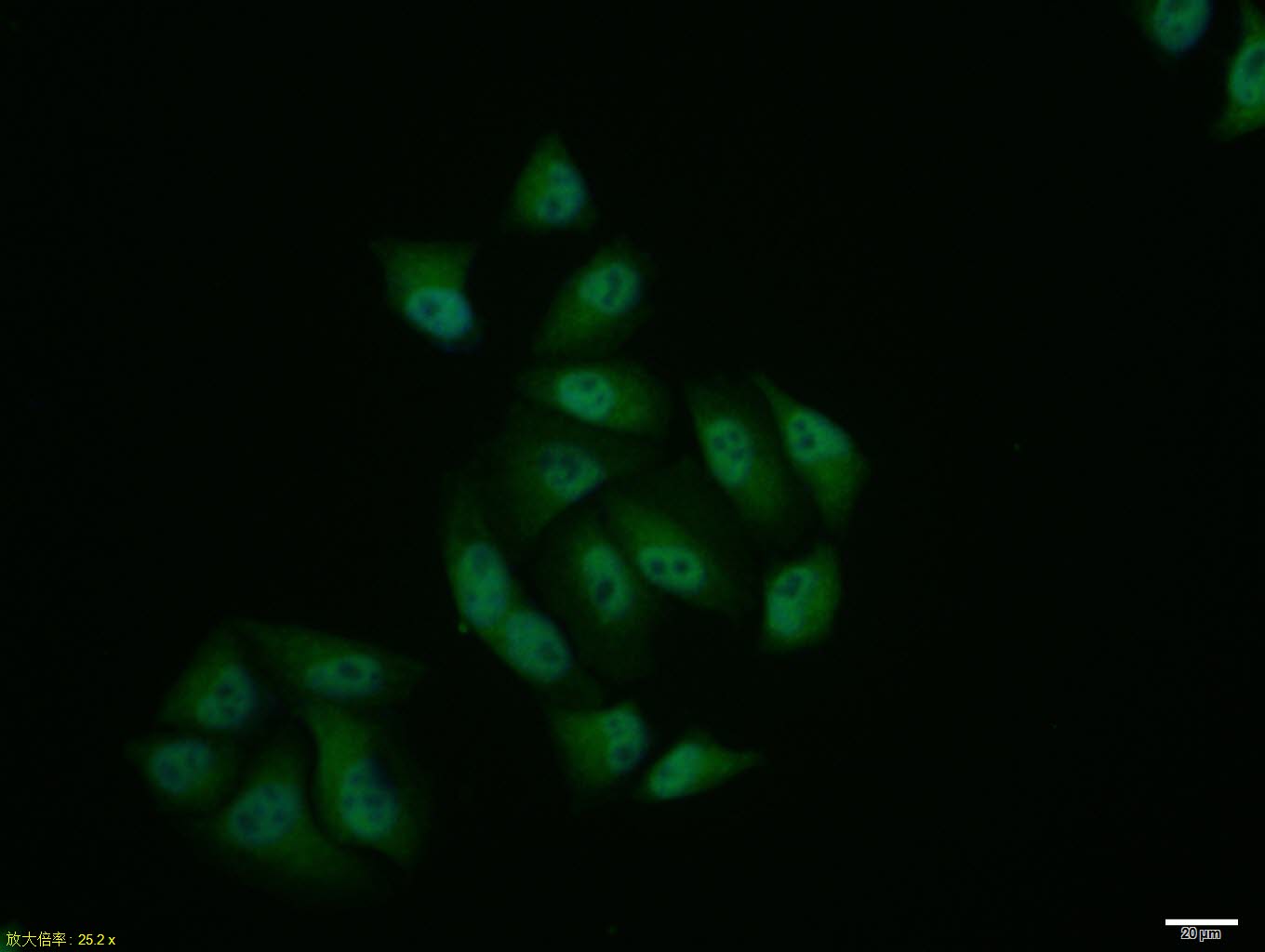 Hela cell; 4% Paraformaldehyde-fixed; Triton X-100 at room temperature for 20 min; Blocking buffer (normal goat serum, C-0005) at 37°C for 20 min; Antibody incubation with (DENTT) polyclonal Antibody, Unconjugated (bs-7051R) 1:100, 90 minutes at 37°C; followed by a conjugated Goat Anti-Rabbit IgG antibody at 37°C for 90 minutes, DAPI (blue, C02-04002) was used to stain the cell nuclei.