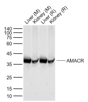 Lane 1: Mouse Liver tissue lysates; Lane 2: Mouse Kidney tissue lysates; Lane 3: Rat Liver tissue lysates; Lane 4: Rat Kidney tissue lysates probed with AMACR Polyclonal Antibody, Unconjugated (bs-0840R) at 1:1000 dilution and 4°C overnight incubation. Followed by conjugated secondary antibody incubation at 1:20000 for 60 min at 37˚C.