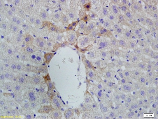 Formalin-fixed and paraffin embedded rat liver labeled with Anti-Vitamin D Receptor/VDR Polyclonal Antibody, Unconjugated (bs-2987R) at 1:200 followed by conjugation to the secondary antibody and DAB staining.