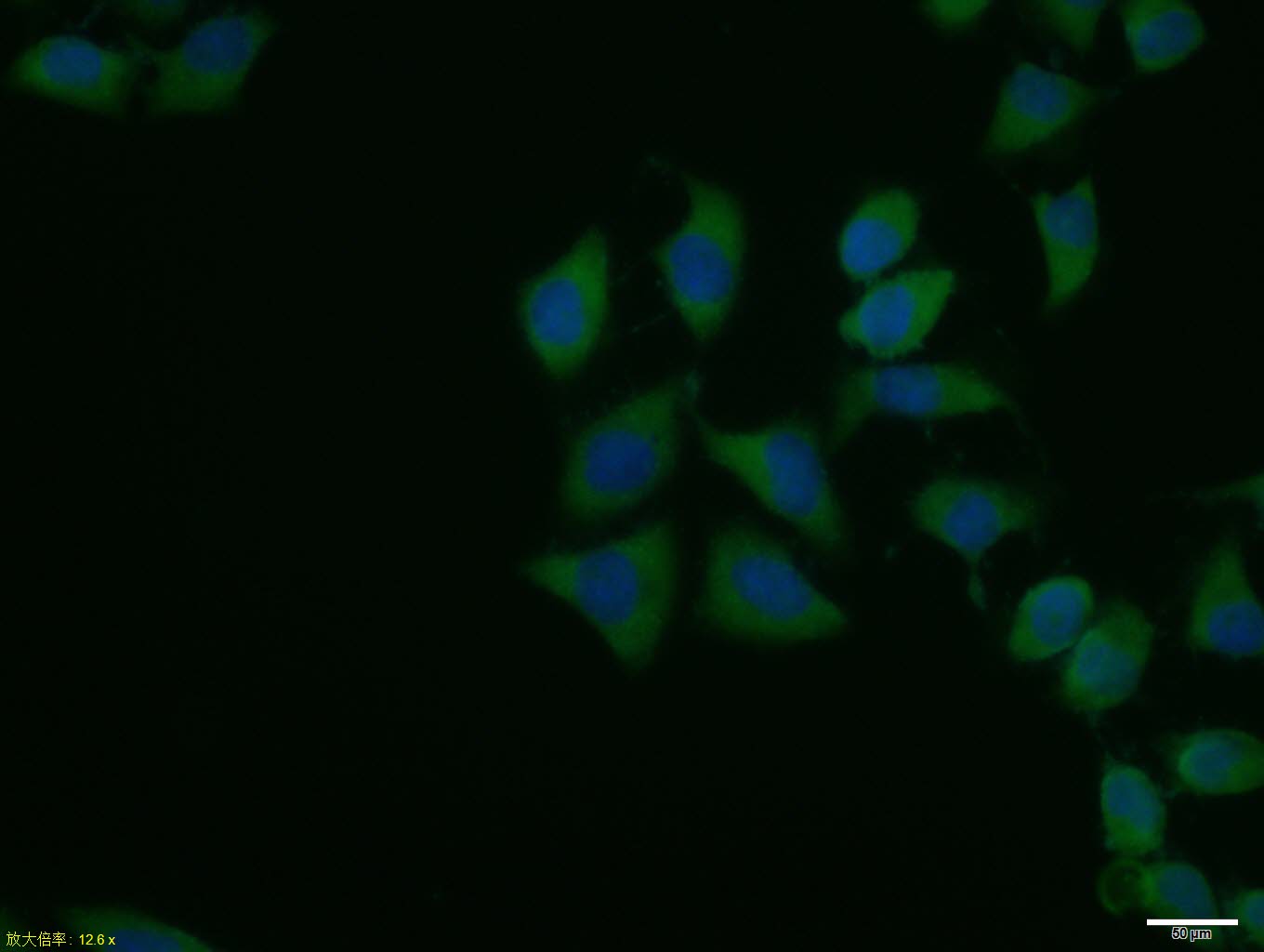 Hela cell; 4% Paraformaldehyde-fixed; Triton X-100 at room temperature for 20 min; Blocking buffer (normal goat serum, C-0005) at 37°C for 20 min; Antibody incubation with (HSP90 alpha) polyclonal Antibody, Unconjugated (bs-10100R) 1:100, 90 minutes at 37°C; followed by a conjugated Goat Anti-Rabbit IgG antibody at 37°C for 90 minutes, DAPI (blue, C02-04002) was used to stain the cell nuclei.