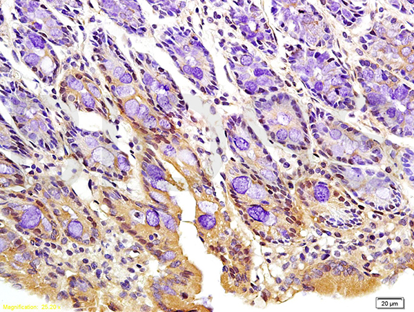 Formalin-fixed and paraffin embedded rat colon tissue labeled with Anti-Phospho-FoxO3a (Ser318/321) Polyclonal Antibody, Unconjugated (bs-3138R) at 1:200 followed by conjugation to the secondary antibody and DAB staining