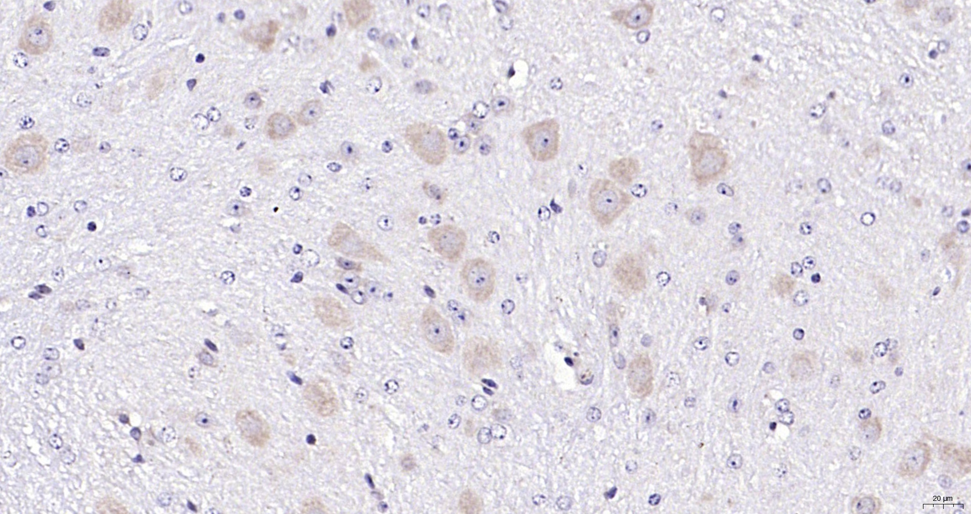 Paraformaldehyde-fixed, paraffin embedded (mouse cerebellum); Antigen retrieval by boiling in sodium citrate buffer (pH6.0) for 15min; Block endogenous peroxidase by 3% hydrogen peroxide for 20 minutes; Blocking buffer (normal goat serum) at 37°C for 30min; Antibody incubation with (Neurotrophin 3 ) Polyclonal Antibody, Unconjugated (bs-0160R) at 1:1000 overnight at 4°C, followed by operating according to SP Kit(Rabbit) (sp-0023) instructionsand DAB staining.