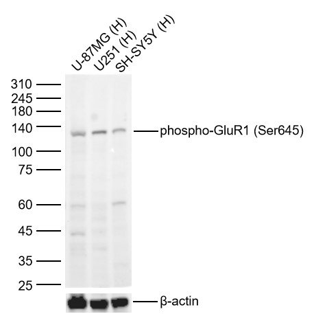 Lane 1: Human U-87 MG cell Lysates; Lane 2: Human U251 cell Lysates; Lane 3: Human SH-SY5Y cell Lysates. Probed with phospho-GluR1 (Ser645) polyclonal Antibody, unconjugated (bs-11633R) at 1:1000 dilution and 4°C overnight incubation. Followed by conjugated secondary antibody incubation at 1:20000 for 60 min at 37˚C.