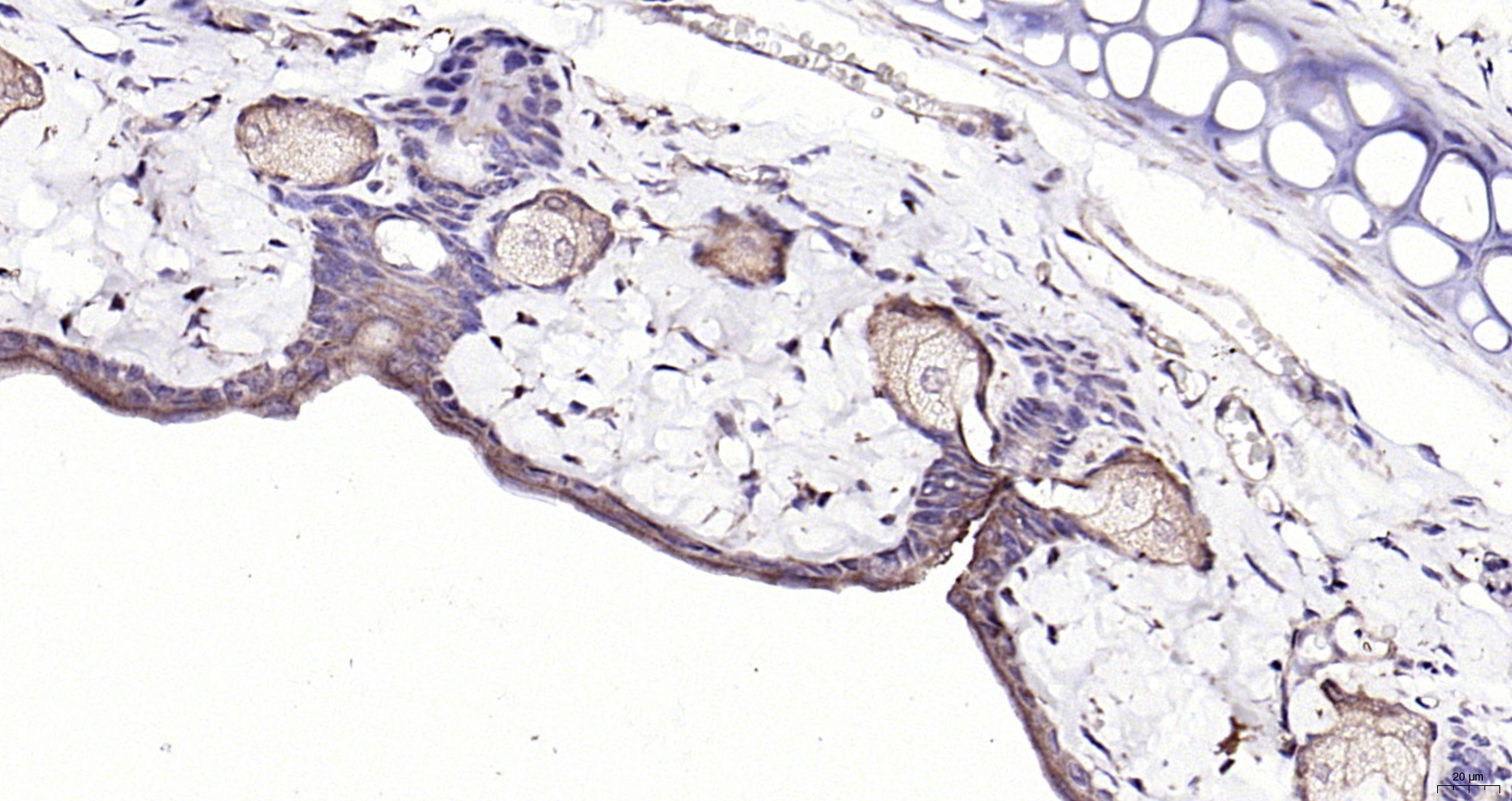 Paraformaldehyde-fixed, paraffin embedded (rat skin); Antigen retrieval by boiling in sodium citrate buffer (pH6.0) for 15min; Block endogenous peroxidase by 3% hydrogen peroxide for 20 minutes; Blocking buffer (normal goat serum) at 37°C for 30min; Antibody incubation with (Neurotrophin 3 ) Polyclonal Antibody, Unconjugated (bs-0160R) at 1:1000 overnight at 4°C, followed by operating according to SP Kit(Rabbit) (sp-0023) instructionsand DAB staining.