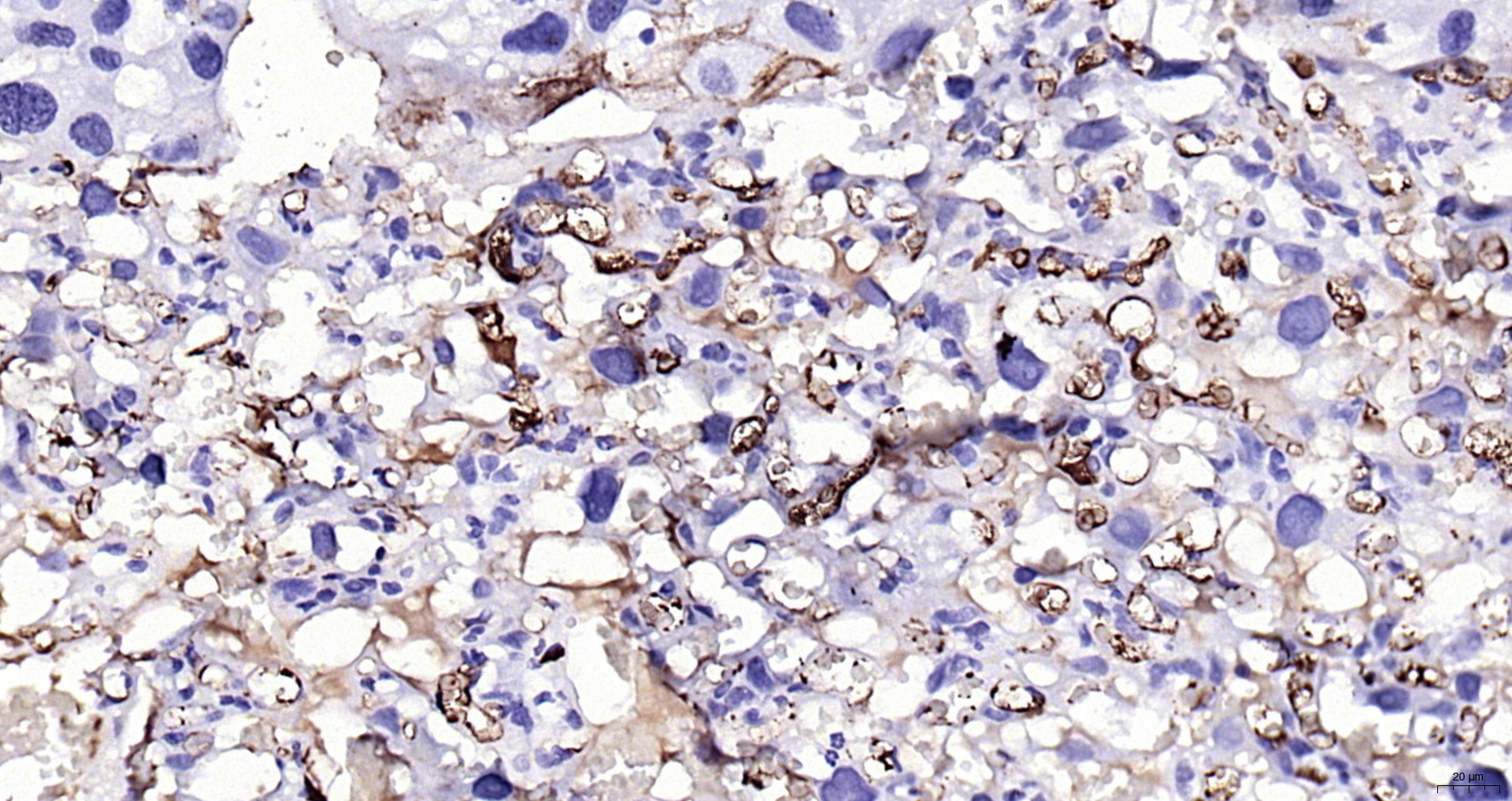 Paraformaldehyde-fixed, paraffin embedded (rat placenta); Antigen retrieval by boiling in sodium citrate buffer (pH6.0) for 15min; Block endogenous peroxidase by 3% hydrogen peroxide for 20 minutes; Blocking buffer (normal goat serum) at 37°C for 30min; Antibody incubation with (Fibrinogen alpha chain) Polyclonal Antibody, Unconjugated (bs-7548R) at 1:200 overnight at 4°C, followed by operating according to SP Kit(Rabbit) (sp-0023) instructionsand DAB staining.