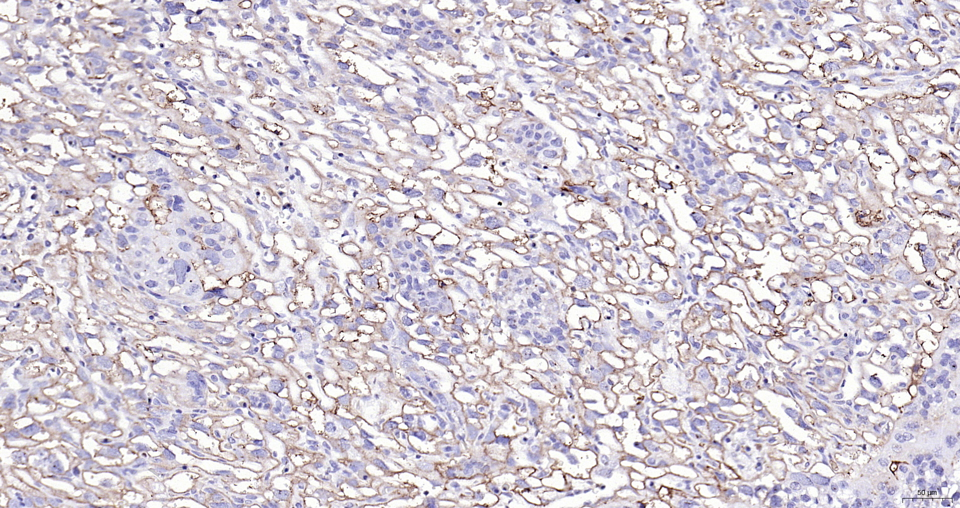 Paraformaldehyde-fixed, paraffin embedded (MOUSE placenta); Antigen retrieval by boiling in sodium citrate buffer (pH6.0) for 15min; Block endogenous peroxidase by 3% hydrogen peroxide for 20 minutes; Blocking buffer (normal goat serum) at 37°C for 30min; Antibody incubation with (Fibrinogen alpha chain) Polyclonal Antibody, Unconjugated (bs-7548R) at 1:200 overnight at 4°C, followed by operating according to SP Kit(Rabbit) (sp-0023) instructionsand DAB staining.