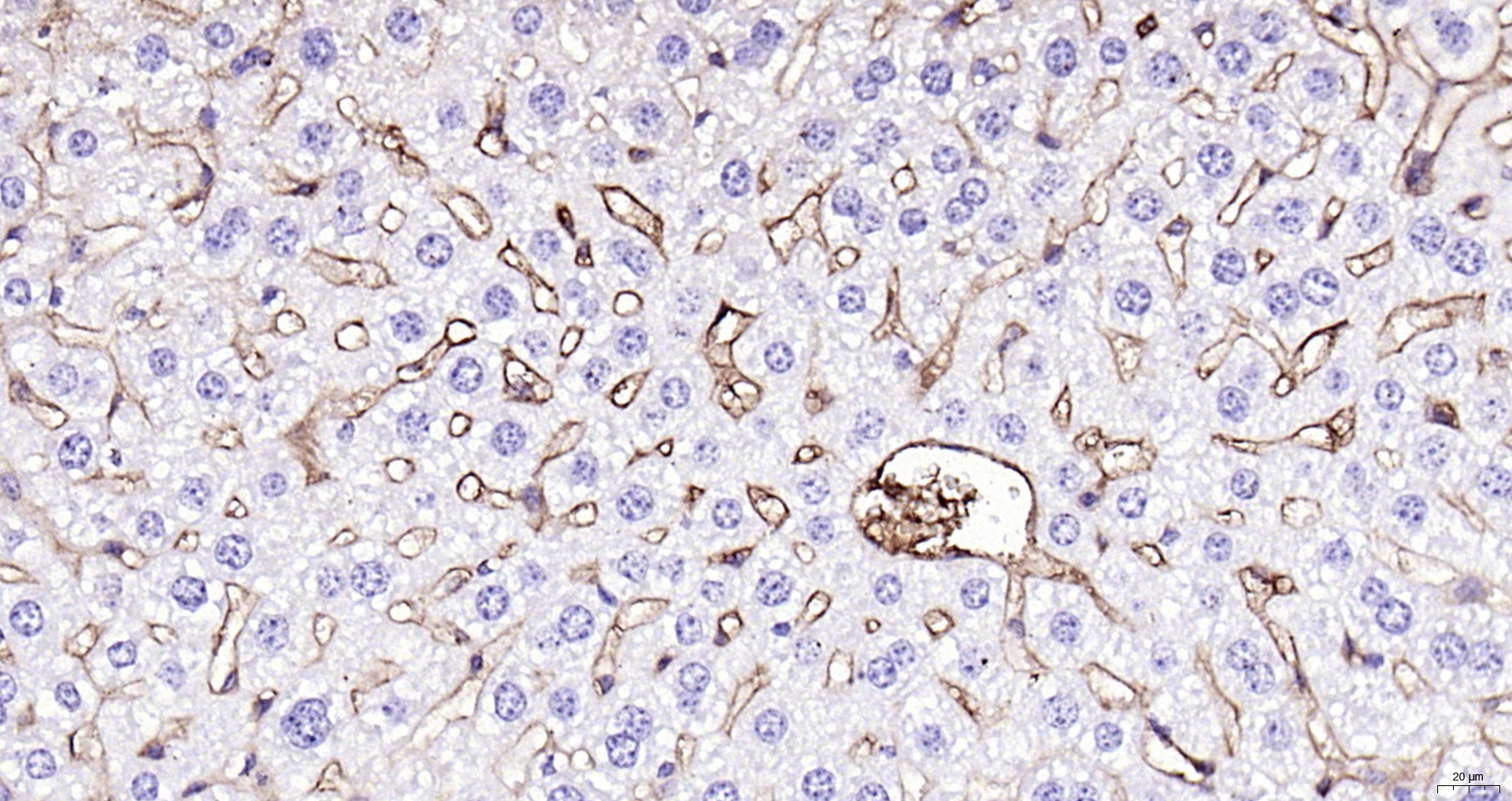 Paraformaldehyde-fixed, paraffin embedded (MOUSE liver); Antigen retrieval by boiling in sodium citrate buffer (pH6.0) for 15min; Block endogenous peroxidase by 3% hydrogen peroxide for 20 minutes; Blocking buffer (normal goat serum) at 37°C for 30min; Antibody incubation with (Fibrinogen alpha chain) Polyclonal Antibody, Unconjugated (bs-7548R) at 1:200 overnight at 4°C, followed by operating according to SP Kit(Rabbit) (sp-0023) instructionsand DAB staining.