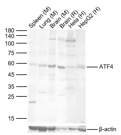 Lane 1: Mouse Spleen Lysates; Lane 2: Mouse Lung Lysates; Lane 3: Mouse Brain Lysates; Lane 4: Rat Brain Lysates; Lane 5: Human Hela cell Lysates; Lane 6: Human HepG2 cell Lysates. Probed with ATF4 polyclonal Antibody, unconjugated (bs-1531R) at 1:1000 dilution and 4°C overnight incubation. Followed by conjugated secondary antibody incubation at 1:20000 for 60 min at 37˚C.