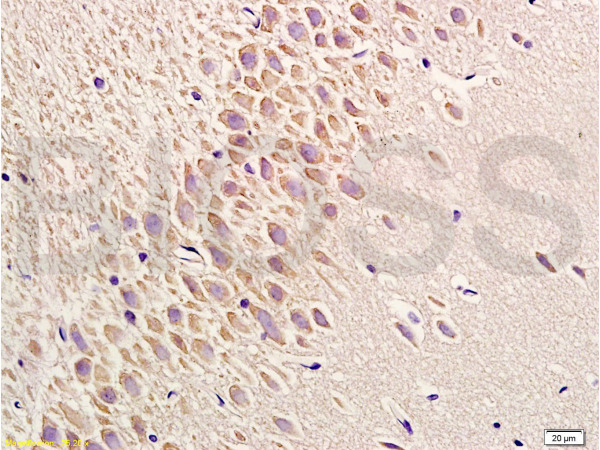 Formalin-fixed and paraffin embedded rat brain labeled with Anti-Phospho-PERK(Thr980) Polyclonal Antibody, Unconjugated (bs-3330R) at 1:200 followed by conjugation to the secondary antibody and DAB staining