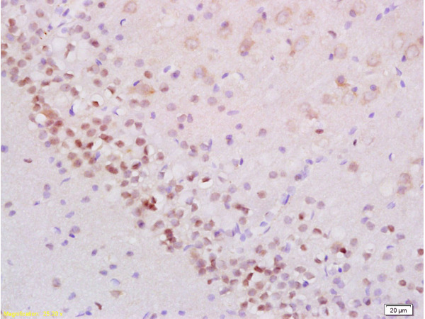 Formalin-fixed and paraffin embedded rat brain labeled with Anti-Phospho-Stat2 (Tyr690) Polyclonal Antibody, Unconjugated (bs-3428R) at 1:200 followed by conjugation to the secondary antibody and DAB staining