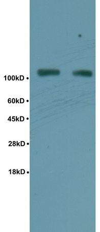 Human rectal carcinoma lysates probed with Anti Phospho-TIF1 beta(Ser824) Polyclonal Antibody, Unconjugated (bs-3423R) at 1:200 overnight at 4˚C. Followed by conjugation to secondary antibody (bs-0295G-HRP) at 1:3000 for 90 min at 37˚C. Predicted band 41kD. Observed band size:41kD.