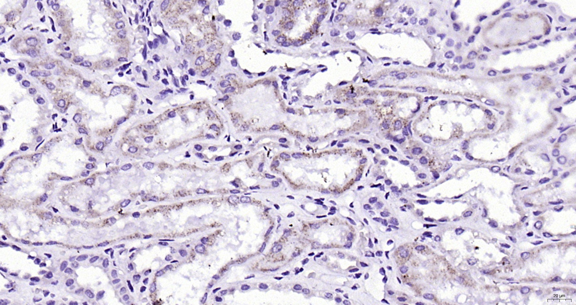 Paraformaldehyde-fixed, paraffin embedded (Human kidney); Antigen retrieval by boiling in sodium citrate buffer (pH6.0) for 15min; Block endogenous peroxidase by 3% hydrogen peroxide for 20 minutes; Blocking buffer (normal goat serum) at 37°C for 30min; Antibody incubation with (AMACR) Polyclonal Antibody, Unconjugated (bs-0840R) at 1:400 overnight at 4°C, followed by operating according to SP Kit(Rabbit) (sp-0023) instructionsand DAB staining.