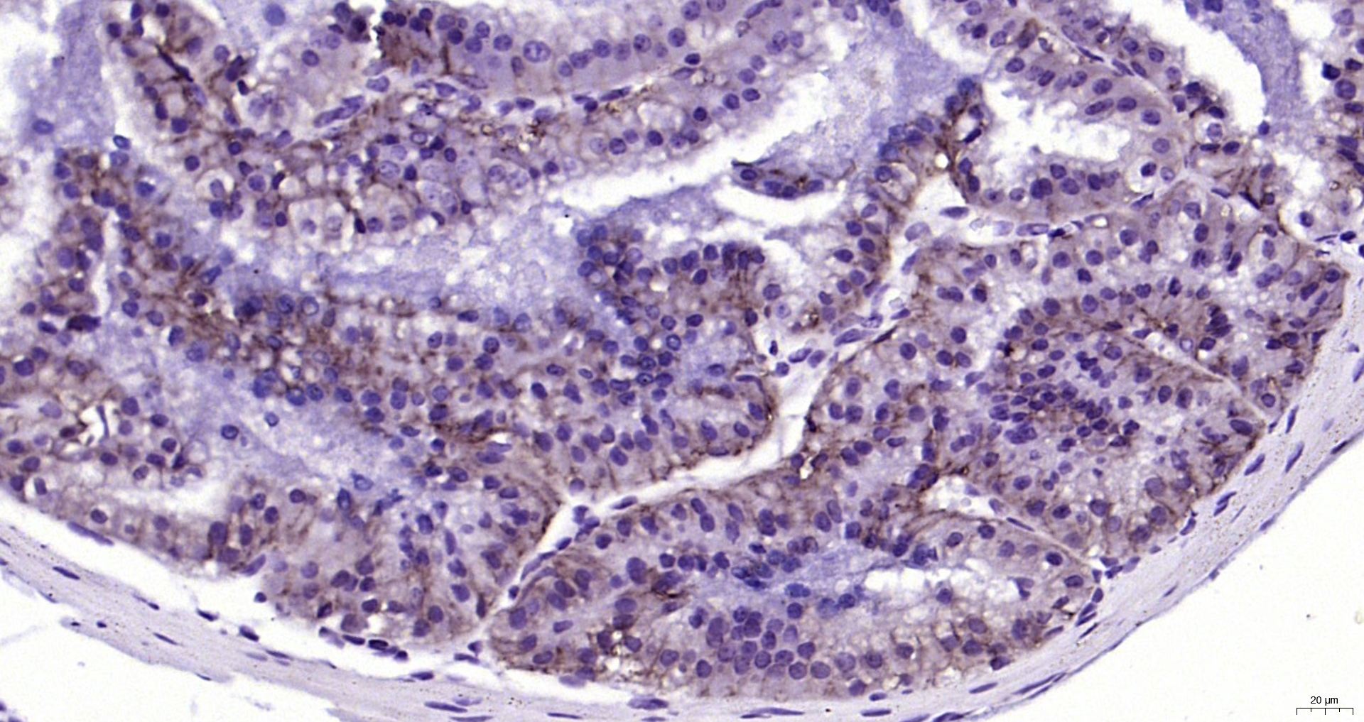 Paraformaldehyde-fixed, paraffin embedded (mouse prostate); Antigen retrieval by boiling in sodium citrate buffer (pH6.0) for 15min; Block endogenous peroxidase by 3% hydrogen peroxide for 20 minutes; Blocking buffer (normal goat serum) at 37°C for 30min; Antibody incubation with (EpCAM) Polyclonal Antibody, Unconjugated (bs-1513R) at 1:200 overnight at 4°C, followed by operating according to SP Kit(Rabbit) (sp-0023) instructionsand DAB staining.
