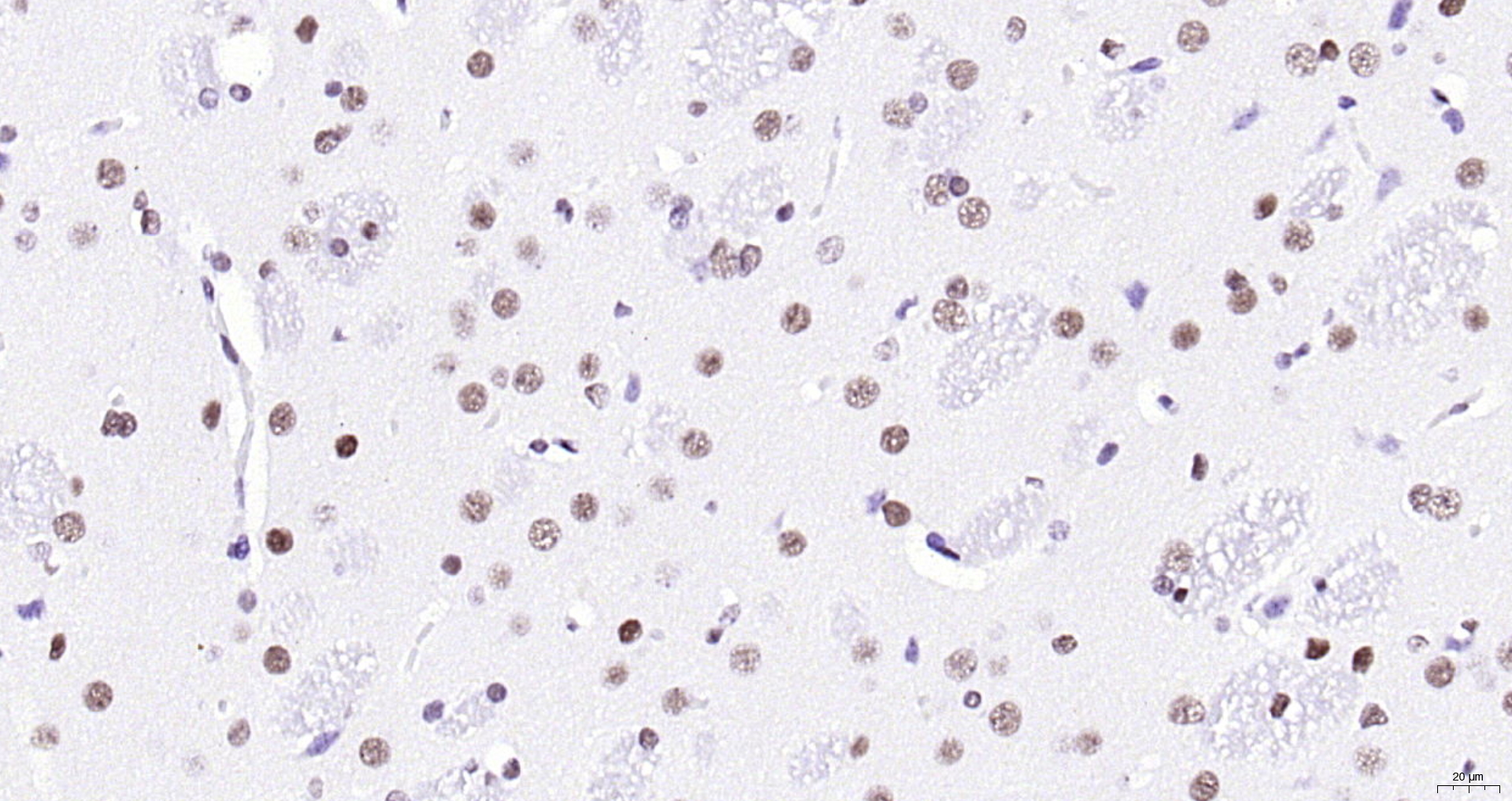 Paraformaldehyde-fixed, paraffin embedded (rat brain); Antigen retrieval by boiling in sodium citrate buffer (pH6.0) for 15min; Block endogenous peroxidase by 3% hydrogen peroxide for 20 minutes; Blocking buffer (normal goat serum) at 37°C for 30min; Antibody incubation with (KLHL7) Polyclonal Antibody, Unconjugated (bs-5935R) at 1:200 overnight at 4°C, followed by operating according to SP Kit(Rabbit) (sp-0023) instructionsand DAB staining.